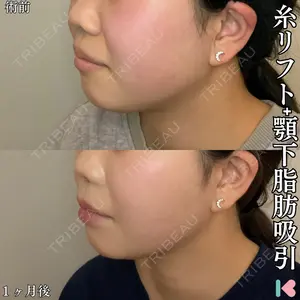 形成外科と美容外科のクリニック池袋 春日 航医師の症例