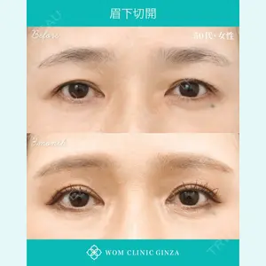 症例