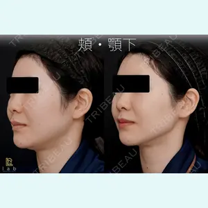 症例