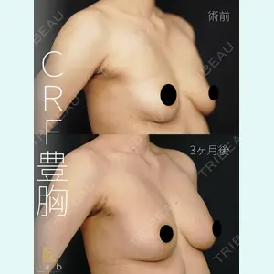 症例