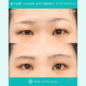 症例