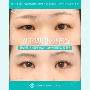 症例