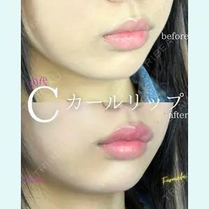 ルラ美容クリニック 新宿院の症例
