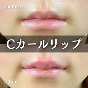 ルラ美容クリニック 新宿院 陶 美梨医師の症例