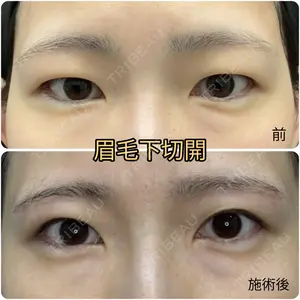 症例