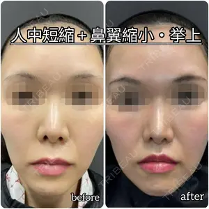 ゆきスキンクリニック 東池袋 小林 智之医師の症例