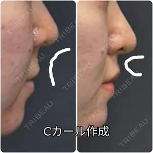 ゆきスキンクリニック 東池袋 小林 智之医師の症例