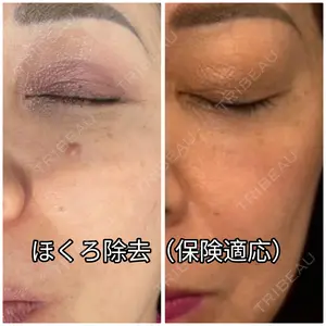 ゆきスキンクリニック 東池袋の症例