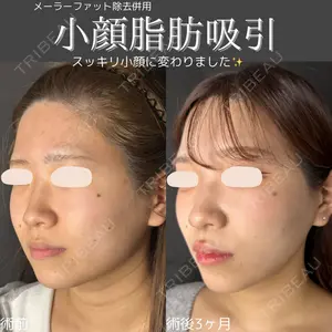 ルラ美容クリニック 仙台院 橋本 英樹医師の症例