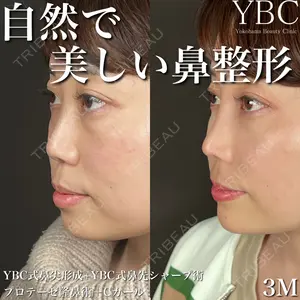 YBC横浜美容外科 大宮院 磯村 亮輔医師の症例