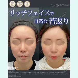 症例
