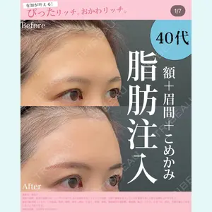 症例