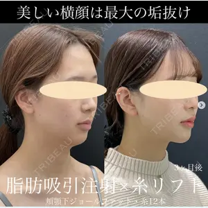 症例