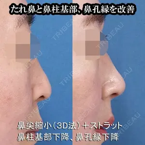 もとび美容外科クリニック 新宿院 西尾 謙三郎医師の症例