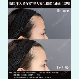 症例