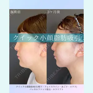 ルラ美容クリニック 札幌院 佐藤 雄紀医師の症例