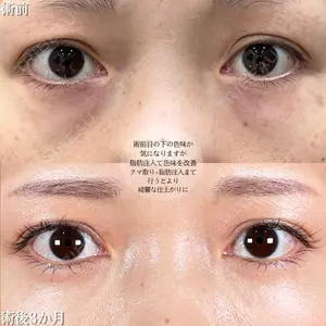 アリエル美容クリニック 大宮院 鈴木　桂介医師の症例