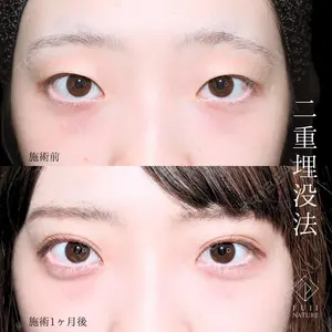 藤・ナチュレ美容クリニック 銀座院 小川 杏平医師の症例