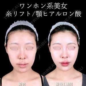アリエル美容クリニック 大宮院 鈴木　桂介医師の症例