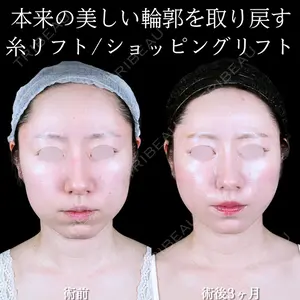 アリエル美容クリニック 大宮院 鈴木　桂介医師の症例