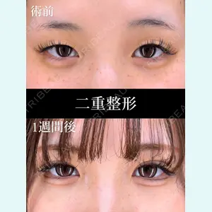 症例