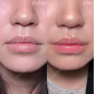 R Beauty CLINIC 銀座院 村山史朗医師の症例
