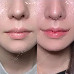 R Beauty CLINIC 銀座院 村山史朗医師の症例