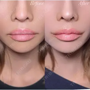 R Beauty CLINIC 銀座院 村山史朗医師の症例
