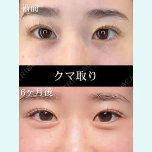 症例