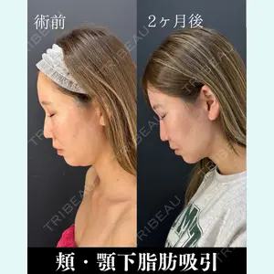 HAAB×DREAM BEAUTY CLINIC 東京本院 吉岡 修一医師の症例