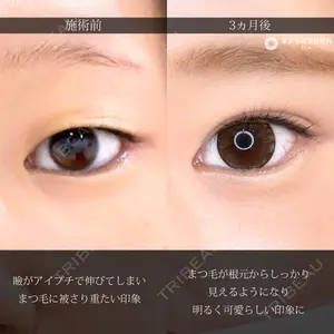 東京形成美容外科 船橋院 弓削田　浩主医師の症例