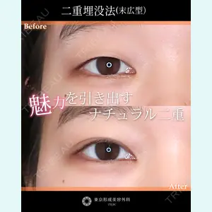 東京形成美容外科 船橋院 山田 大輔医師の症例