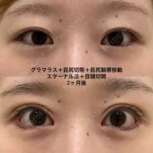 エターナル美容クリニック 久門田 詳医師の症例