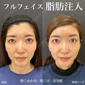 ルラ美容クリニック 名古屋栄院 関戸 優医師の症例