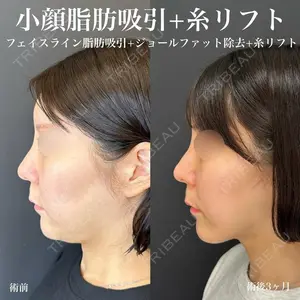 ルラ美容クリニック 名古屋栄院 関戸 優医師の症例