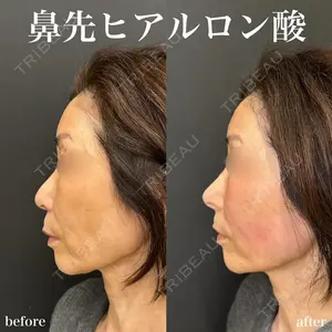 ルラ美容クリニック 名古屋栄院 関戸 優医師の症例