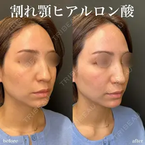 ルラ美容クリニック 名古屋栄院 関戸 優医師の症例