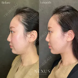 NEXUS CLINICの症例