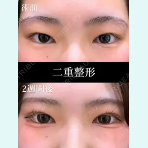 症例
