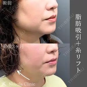 ネビュラクリニック 広島院の症例