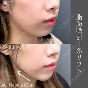 ネビュラクリニック 広島院の症例