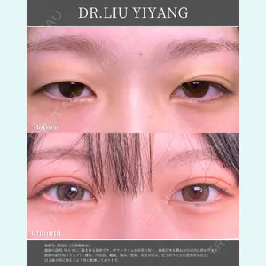 症例
