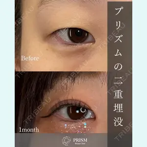 症例