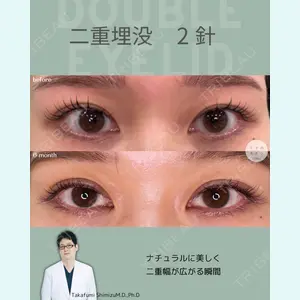 症例