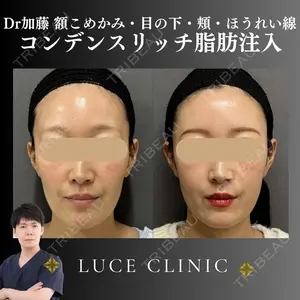 ルーチェクリニック 銀座院 加藤晴之輔医師の症例
