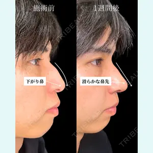 東京シンデレラ美容外科 池袋院 石井 達也医師の症例