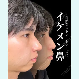 症例