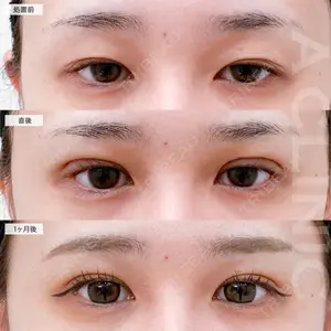 症例