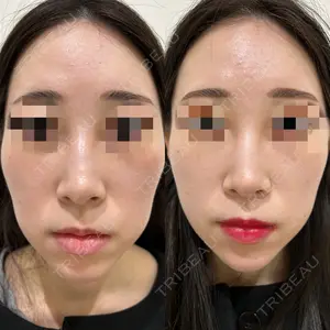 エターナル美容クリニック 久門田 詳医師の症例