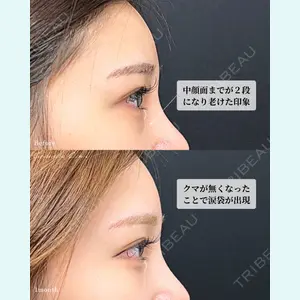 東京シンデレラ美容外科 大宮院 竹田 昌平医師の症例
